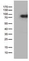 Colony Stimulating Factor 2 Receptor Alpha Subunit antibody, TA812523S, Origene, Western Blot image 