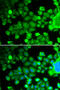 Ribosomal Protein S10 antibody, 19-990, ProSci, Immunofluorescence image 