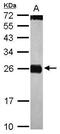 Cell death activator CIDE-3 antibody, GTX111008, GeneTex, Western Blot image 