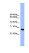 Chromosome 1 Open Reading Frame 216 antibody, NBP1-69165, Novus Biologicals, Western Blot image 