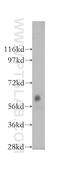 Dystrobrevin beta antibody, 12045-1-AP, Proteintech Group, Western Blot image 