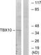 T-Box 10 antibody, PA5-38541, Invitrogen Antibodies, Western Blot image 