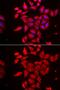 Tropomodulin 4 antibody, GTX32937, GeneTex, Immunofluorescence image 