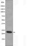 Recoverin antibody, orb225721, Biorbyt, Western Blot image 