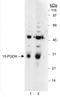 15-Hydroxyprostaglandin Dehydrogenase antibody, NB200-179H, Novus Biologicals, Western Blot image 