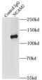 Neural Cell Adhesion Molecule 2 antibody, FNab05576, FineTest, Immunoprecipitation image 