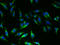 Thyroid Stimulating Hormone Receptor antibody, A53714-100, Epigentek, Immunofluorescence image 