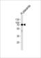 Alkaline Phosphatase, Placental antibody, 58-008, ProSci, Western Blot image 