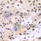 ETS Proto-Oncogene 1, Transcription Factor antibody, A1596, ABclonal Technology, Immunohistochemistry paraffin image 