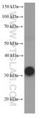 R-Spondin 3 antibody, 66314-1-Ig, Proteintech Group, Enzyme Linked Immunosorbent Assay image 
