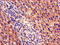 Proteasome Subunit Beta 5 antibody, CSB-PA010083LA01HU, Cusabio, Immunohistochemistry paraffin image 