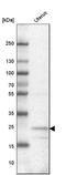 F-Box And Leucine Rich Repeat Protein 22 antibody, HPA047624, Atlas Antibodies, Western Blot image 
