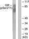 Glucocorticoid receptor antibody, TA313370, Origene, Western Blot image 