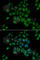 Protoporphyrinogen oxidase antibody, A6397, ABclonal Technology, Immunohistochemistry paraffin image 