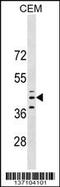 Glutaminyl-Peptide Cyclotransferase antibody, 59-199, ProSci, Western Blot image 