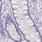 Myomesin-1 antibody, PA5-61907, Invitrogen Antibodies, Immunohistochemistry frozen image 