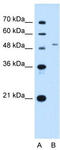 Solute Carrier Family 29 Member 2 antibody, TA334056, Origene, Western Blot image 