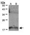 Interleukin 36 Gamma antibody, PA5-21945, Invitrogen Antibodies, Western Blot image 