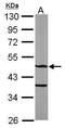 Ankyrin Repeat And SOCS Box Containing 4 antibody, TA308088, Origene, Western Blot image 
