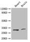 Cyclin Dependent Kinase 5 antibody, A50121-100, Epigentek, Western Blot image 