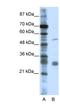 Leucine Rich Repeat Containing 14 antibody, NBP1-80049, Novus Biologicals, Western Blot image 
