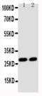 Glutathione S-Transferase Theta 1 antibody, PA5-79342, Invitrogen Antibodies, Western Blot image 