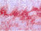 S100A8 antibody, BM4028B, Origene, Immunohistochemistry paraffin image 