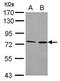 Cytochrome P450 Family 4 Subfamily F Member 2 antibody, GTX102722, GeneTex, Western Blot image 