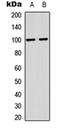 Glutamate Ionotropic Receptor AMPA Type Subunit 2 antibody, orb256572, Biorbyt, Western Blot image 