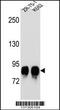 Protein O-Mannosyltransferase 1 antibody, 56-386, ProSci, Western Blot image 