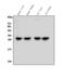 Carboxymethylenebutenolidase Homolog antibody, A04921, Boster Biological Technology, Western Blot image 
