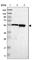 Chromosome 17 Open Reading Frame 80 antibody, HPA012896, Atlas Antibodies, Western Blot image 