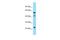 Insulin Like Growth Factor 2 MRNA Binding Protein 1 antibody, NBP2-36473, Novus Biologicals, Western Blot image 