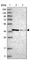 Methionine adenosyltransferase 2 subunit beta antibody, HPA037722, Atlas Antibodies, Western Blot image 