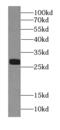 Chymotrypsin Like antibody, FNab01703, FineTest, Western Blot image 