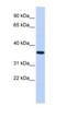 CPX Chromosome Region Candidate 1 antibody, NBP1-80386, Novus Biologicals, Western Blot image 