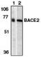 Beta-secretase 2 antibody, MBS396063, MyBioSource, Western Blot image 