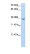 Nudix Hydrolase 13 antibody, NBP1-54929, Novus Biologicals, Western Blot image 