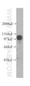 DEAD-Box Helicase 20 antibody, 11324-1-AP, Proteintech Group, Western Blot image 