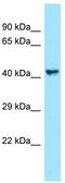 Vascular Endothelial Growth Factor C antibody, TA343278, Origene, Western Blot image 