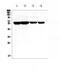 Cytochrome P450 Family 17 Subfamily A Member 1 antibody, A00615-3, Boster Biological Technology, Western Blot image 