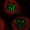 Kinesin Family Member 25 antibody, NBP1-92055, Novus Biologicals, Immunocytochemistry image 