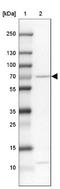Cytochrome P450 Family 4 Subfamily V Member 2 antibody, NBP1-85361, Novus Biologicals, Western Blot image 