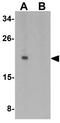 Interleukin 1 Family Member 10 antibody, GTX32121, GeneTex, Western Blot image 