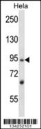 L3MBTL Histone Methyl-Lysine Binding Protein 2 antibody, 57-579, ProSci, Western Blot image 