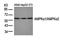 Protein Kinase AMP-Activated Catalytic Subunit Alpha 2 antibody, orb14583, Biorbyt, Western Blot image 