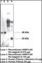 Retinol Binding Protein 4 antibody, orb96208, Biorbyt, Western Blot image 