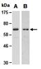 Protein Inhibitor Of Activated STAT 1 antibody, orb66686, Biorbyt, Western Blot image 