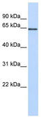 Amine oxidase [flavin-containing] B antibody, TA332354, Origene, Western Blot image 