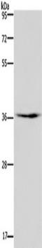 Pim-3 Proto-Oncogene, Serine/Threonine Kinase antibody, TA351349, Origene, Western Blot image 